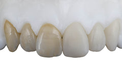 AZR T High Translucen Multilayer Zirconia Disc - 95mm for Zirkonzahn Milling Machine