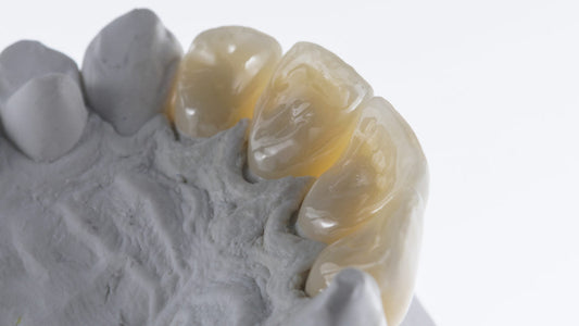 AZR-3D: Next-Generation Multi-Gradient Zirconia for Lifelike Dental Restorations