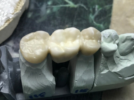 The Real Talk About Zirconia Sintering: What Nobody Tells You Until Things Go Wrong